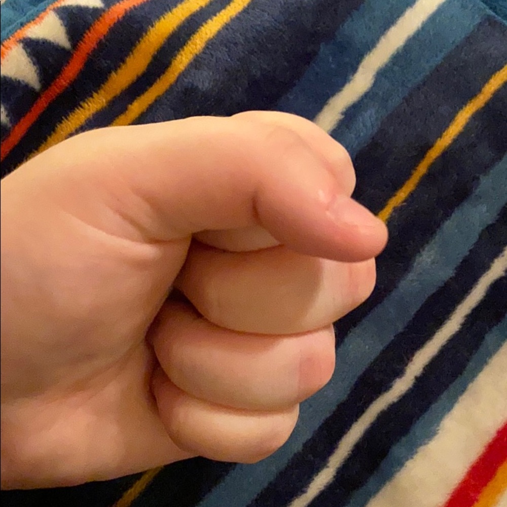 These hands